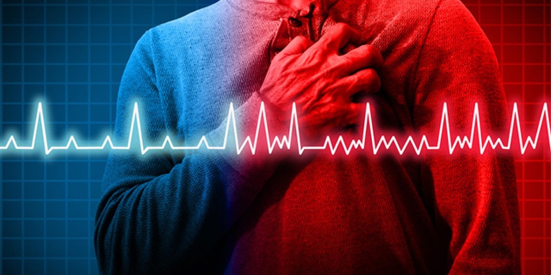 Аритмии сердца: новые методы лечения