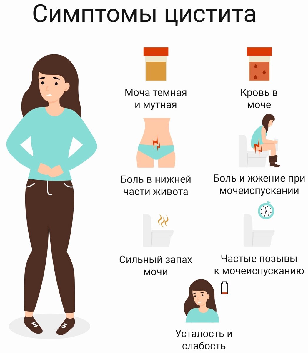 Симптомы цистита
