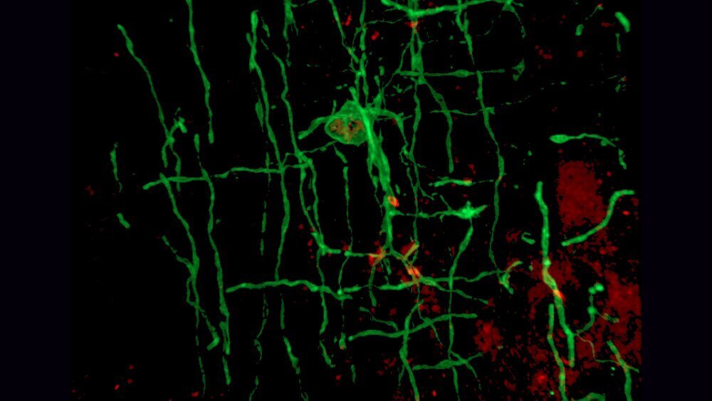    Фото: Peggy Assinck, Altos Labs-Cambridge Institute of Science, Миелинизирующий олигодендроцит (зеленый)
