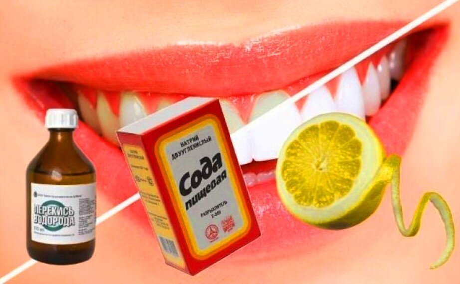 Как можно почистить зубы. Кауотбелить зубы. Профгигиена полости рта air flow. Как чистить зубы. Как правильно чистить зубы.