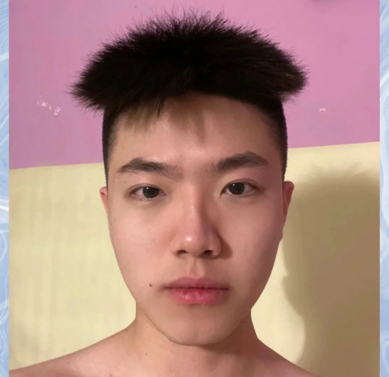 Так плохо, что даже хорошо, похож на морского ежа