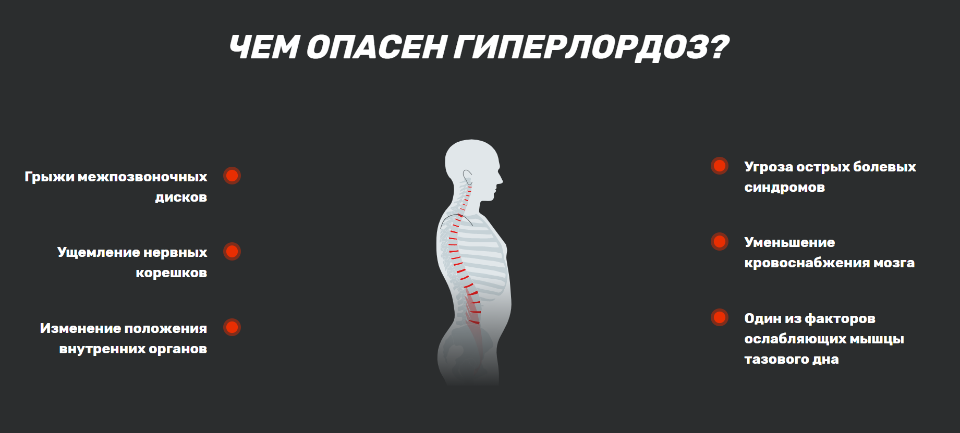 Что такое гиперлордоз поясничного отдела. Гиперлордоз. Гиперлордоз поясничного отдела. Гиперлордоз позвоночника. Гиперлордоза поясничного отдела позвоночника.