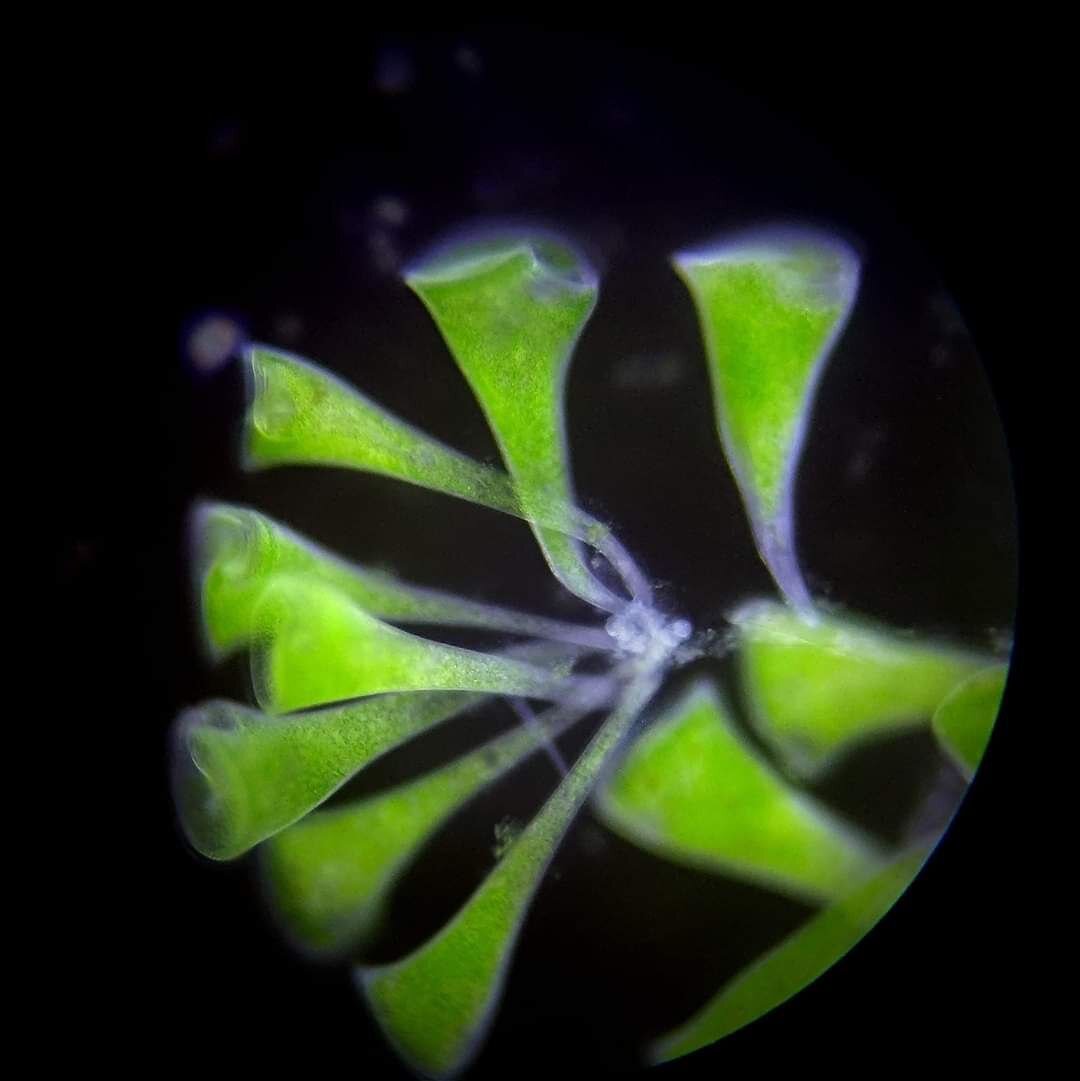 Инфузории трубачи с микроскопическими водорослями-помощниками внутри