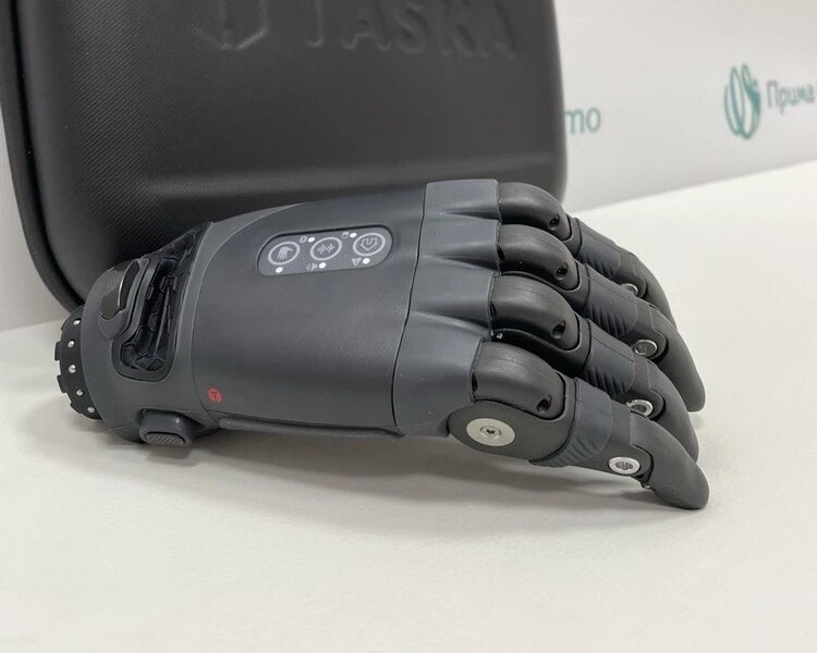 фото предоставлено ООО "Прима Орто" 