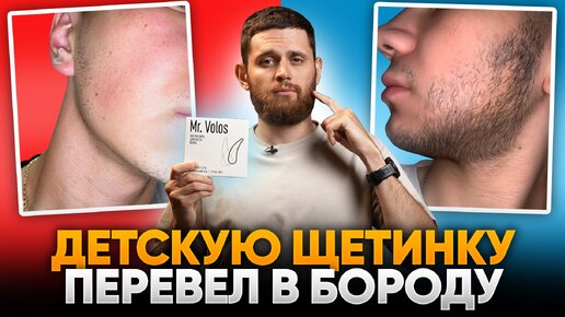 За 3 месяца зарастил бороду в 19 лет / Результаты mr.Volos для роста бороды