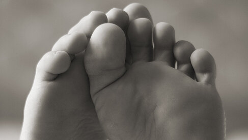 Что делать если опух палец на ноге | Клиника «Здравствуй»