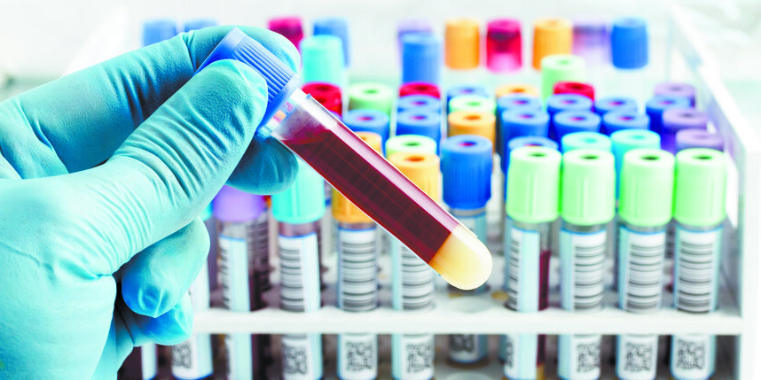    В Сибири разработали метод борьбы с опухолями в организме.Depositphotos