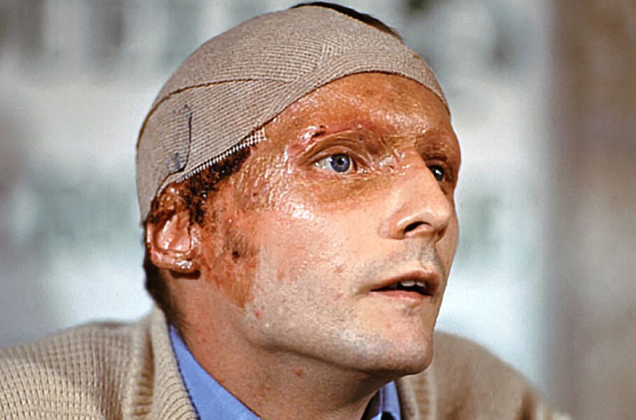 Ники лауда. Ники лауда 1976. Ники лауда 1976. Лауда после аварии. Ники лауда до аварии.