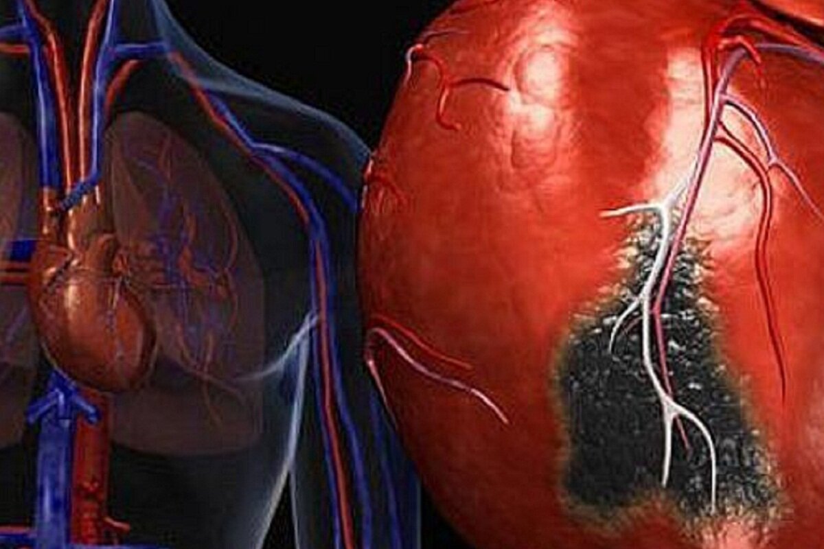 Врач Малышева заявила, что инфаркт можно определить по анализу крови |  RuNews24.ru | Дзен