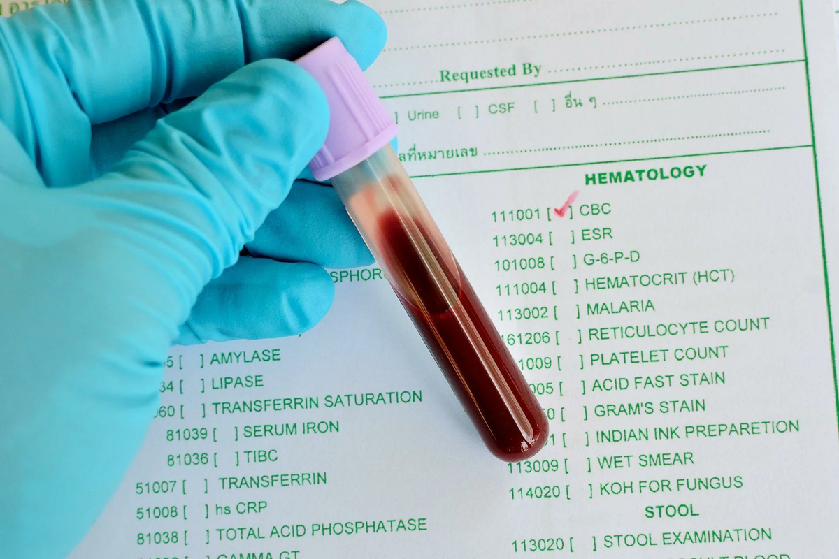 Одним из обязательных исследований при диагностике любых патологий становится общий анализ крови.