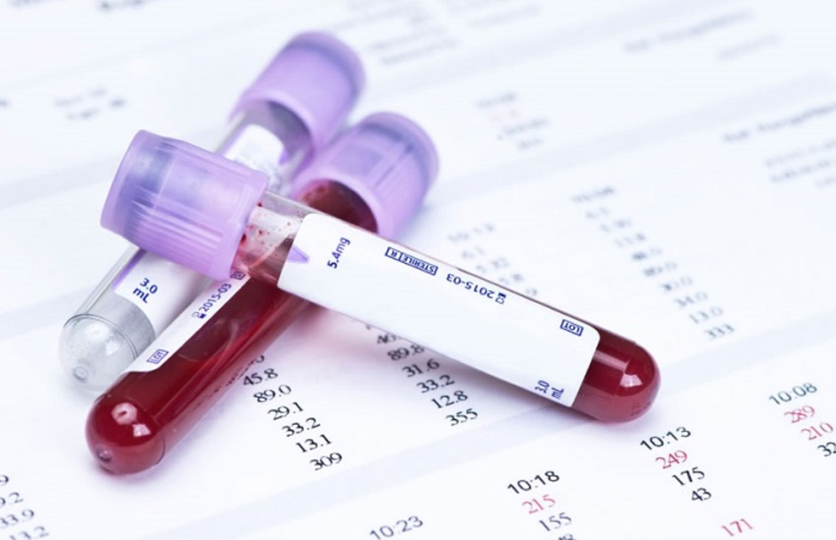 Одним из обязательных исследований при диагностике любых патологий становится общий анализ крови.-2