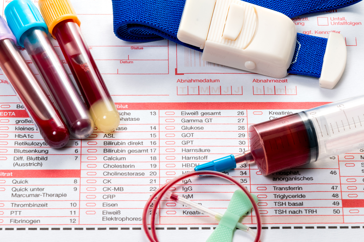 Одним из обязательных исследований при диагностике любых патологий становится общий анализ крови.-5