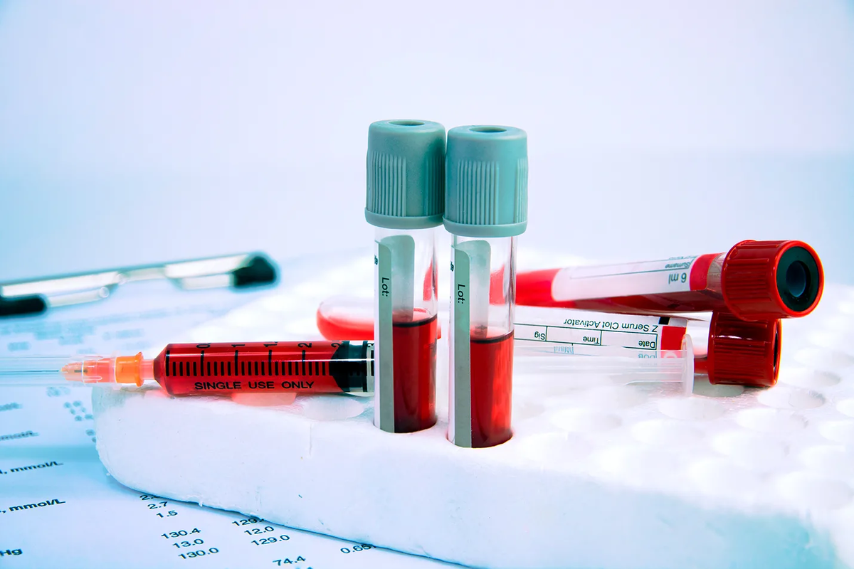 Одним из обязательных исследований при диагностике любых патологий становится общий анализ крови.-6