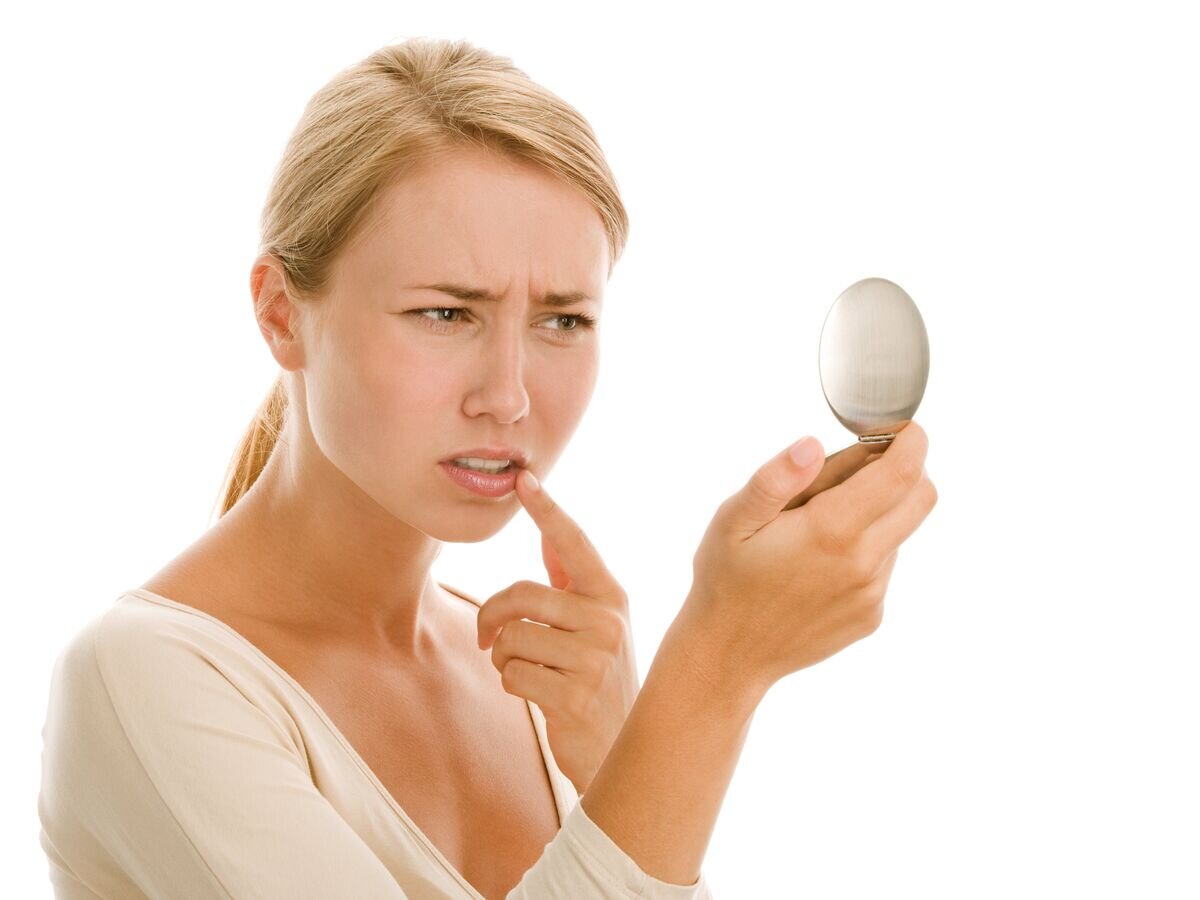    Простуда на губах© Fotolia / studiovespa