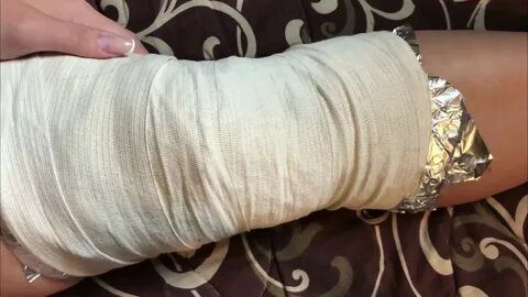 Вот так оборачивается фольгой колено