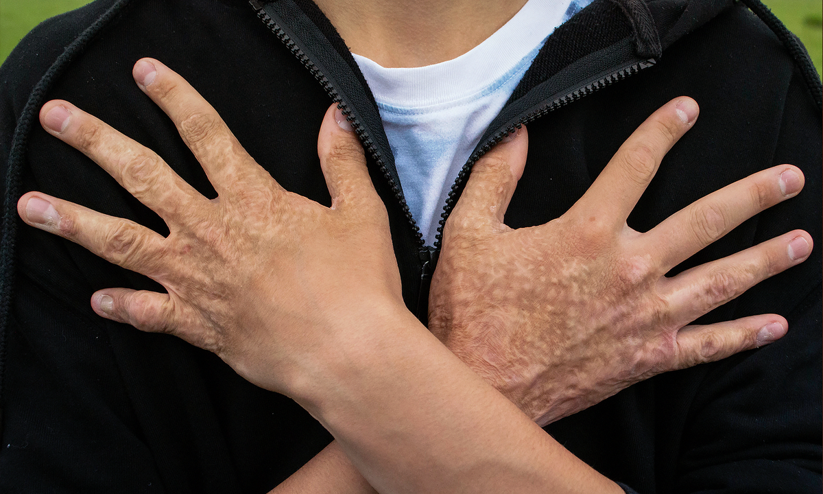 Альберт Фатхуллин, подопечный фонда "Алёша"