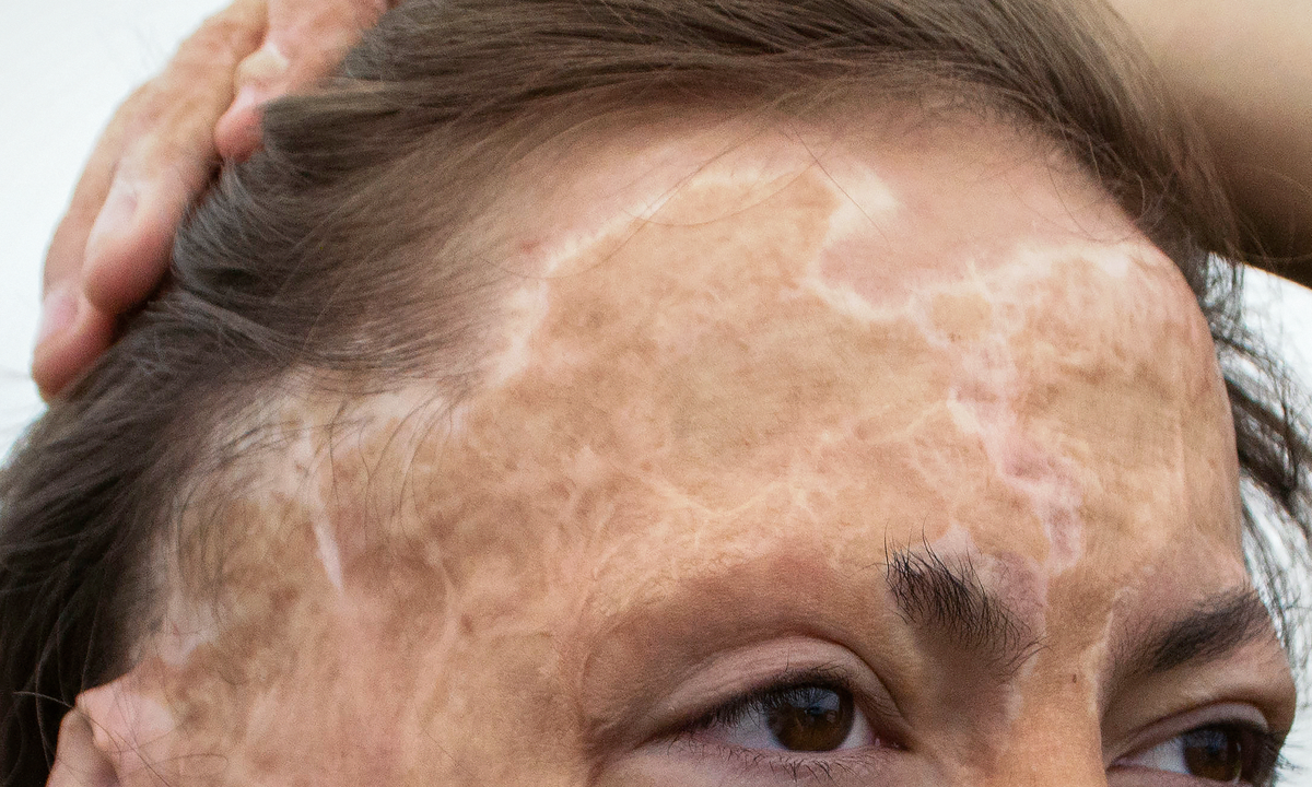 Альберт Фатхуллин, подопечный фонда "Алёша"