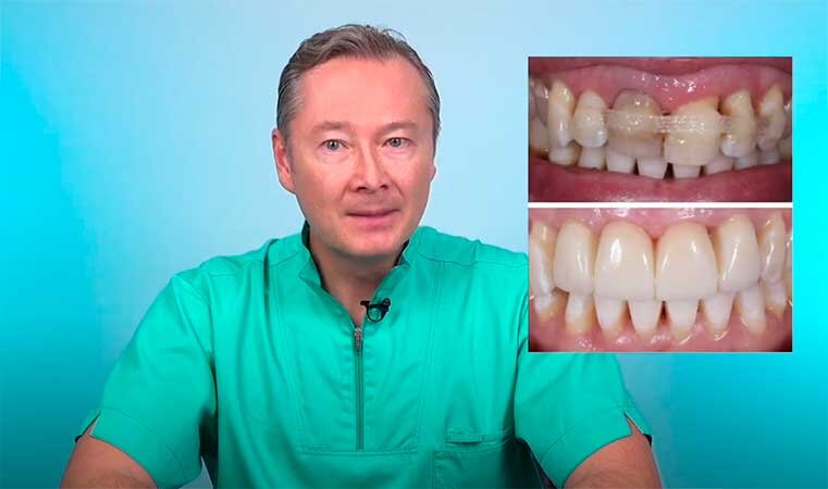 Поработал талантливый зубной техник