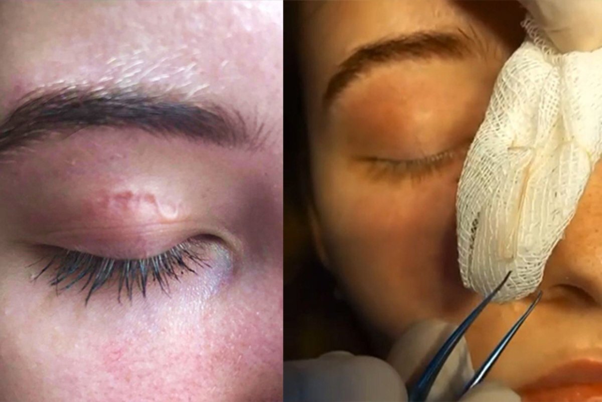    У девушки сильно болел глаз.