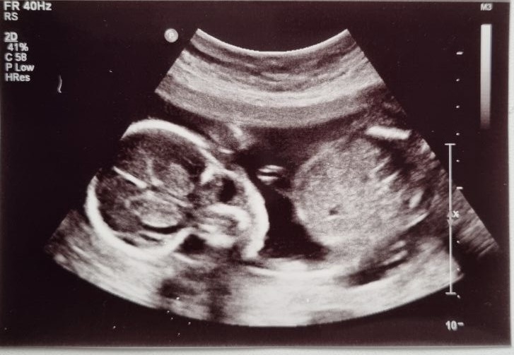 Каких врачей стоит посетить до беременности?