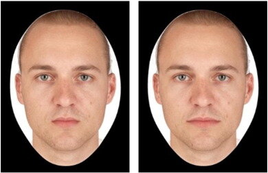 Узкий рот - Широкий рот