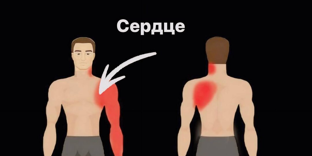 Болевые точки: как определить причину боли при помощи локализации