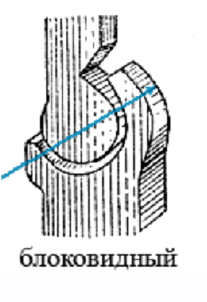 Коленный сустав - блоковидный. Он может только сгибаться и разгибаться.