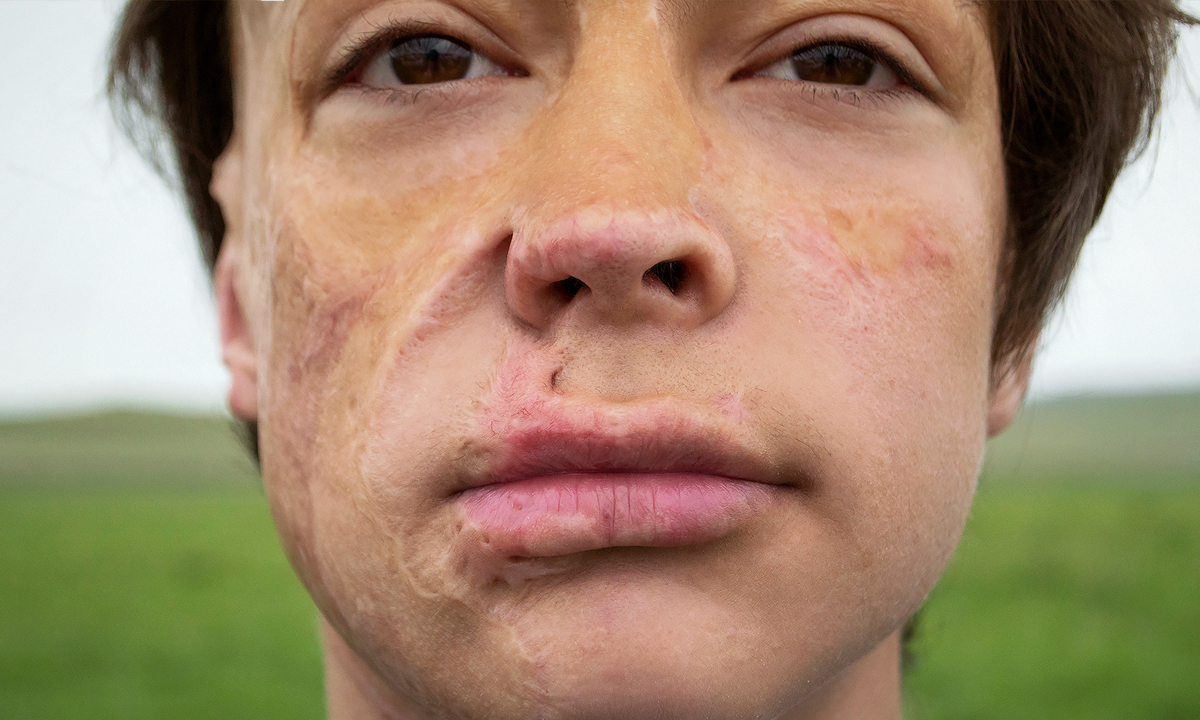 Альберт Фатхуллин, подопечный фонда "Алёша"