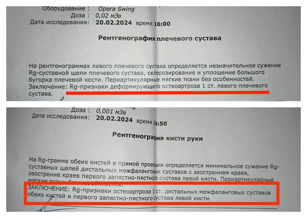 Вы конечно же в курсе, что я опять начала ходить по врачам... 🤕😁 Меня беспокоят кисти и левая рука, от плеча до локтя. Боль в пальцах иногда достигает такой силы, что я даже не могу держать телефон.