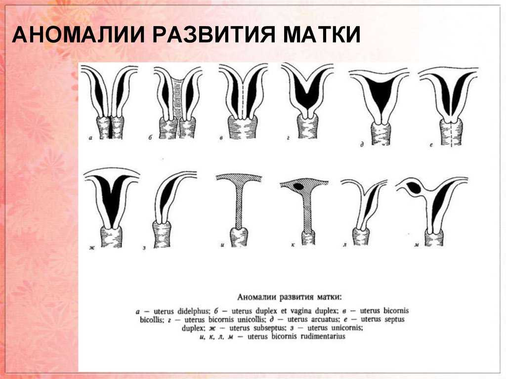 Early signs of cervical cancer Vinmec