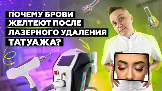 Descargar video: ПОЧЕМУ брови ЖЕЛТЕЮТ после лазерного удаления?