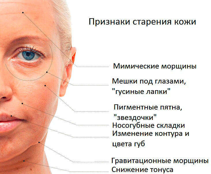    У меня сформировалась собственная гипотеза о морфотипах старения. Я не врач, я инженер, поэтому это только мои личные наблюдения. Сначала официальная точка зрения.