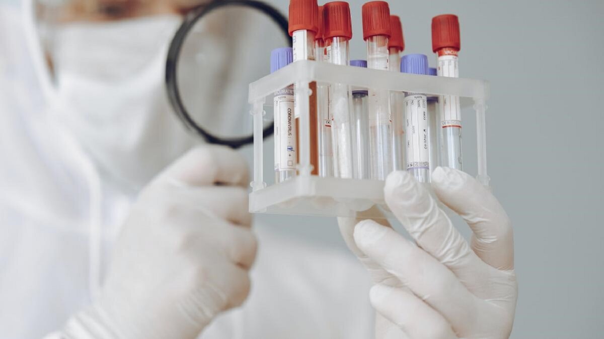 Чтобы диагностировать железодефицитную анемию, Ваш врач назначит анализ крови
