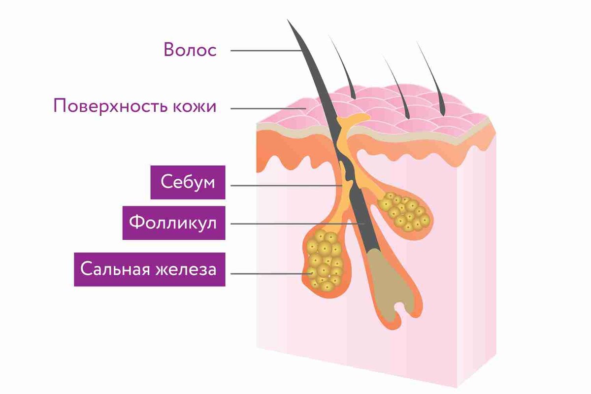 Выпадение волос