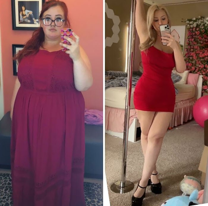 Сильно похудела почему. Обвисла кожа после похудения. Для похудения. Обвисшая кожа после похудения. Сильно похудела почему.