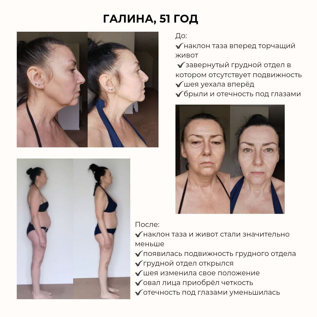 Морщины на лице. Фразы про кожу лица. Омолаживающий крем миафлоу. Девушка с морщинами. Женское лицо косметология.