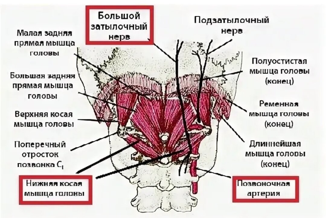 Нижняя косая мышца головы спазм. Косая мышца головы синдром. Блокада нижних косой мышцы. Блокада головы нижняя косая мышца. Подзатылочные мышцы анатомия.