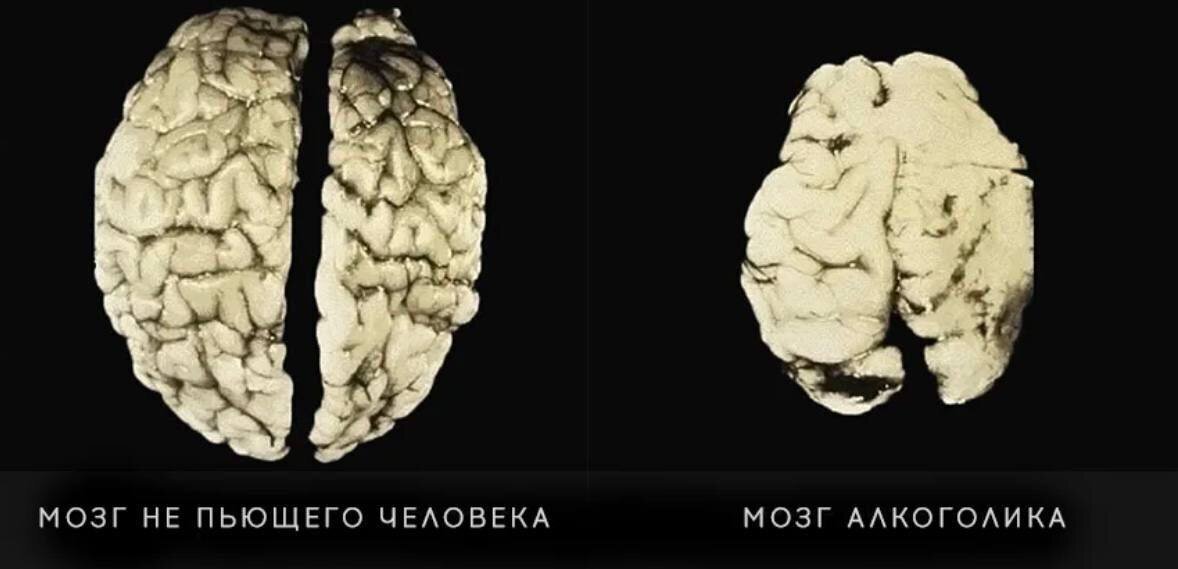 ). Выпивших его душу и мозг троп. Алкоголь и клетки головного мозга. Мозг или душа. Выпивших его душу и мозг троп.