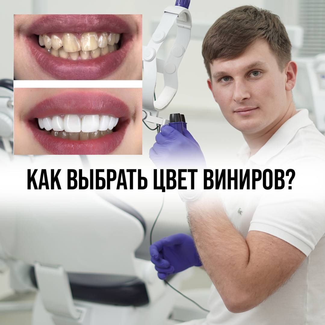 Какого цвета должны быть зубы?