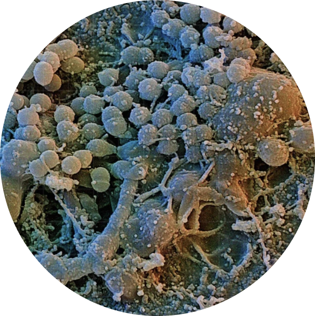 Streptococcus mutans в увеличении под микроскопом