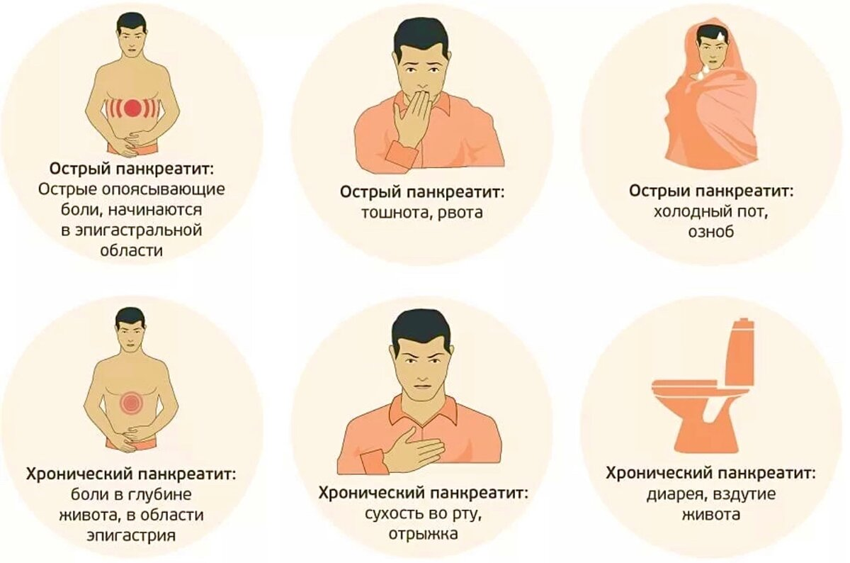 локализация боли в животе. причины боли в боках живота. карта боли в животе. причины боли в боках живота. боль справа внизу живота у женщин.