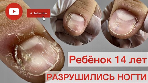 МАМА ПРИВЕЛА СЫНА 14 лет | ИСПОРТИЛ НОГТИ | ГРЫЗЕТ НОГТИ #алена_лаврентьева #nails #грызетногти