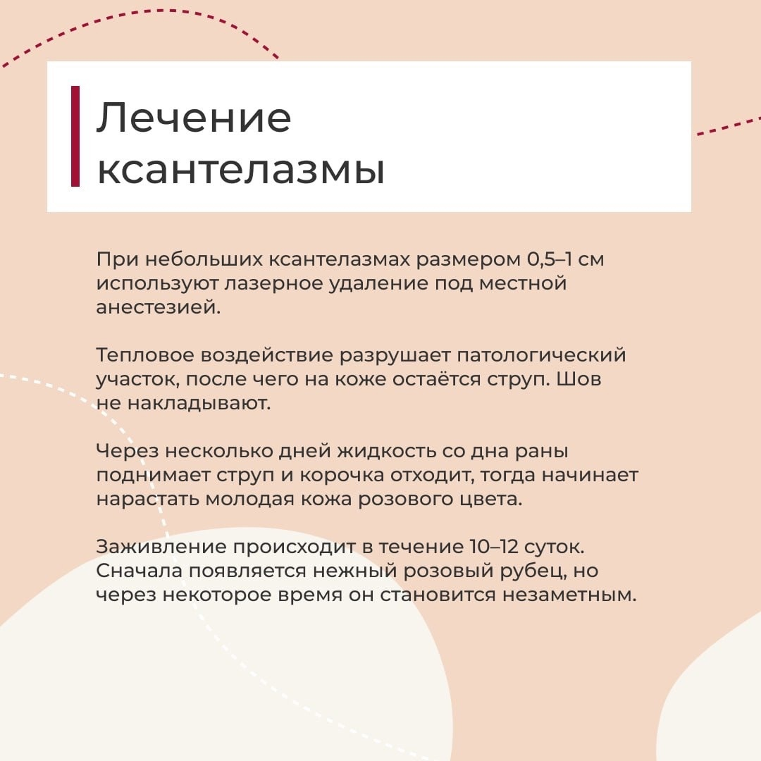 Что такое ксантелазма? Почему они появляются и как их лечить? | Медицинский  центр «Чистая Кожа» | Дзен