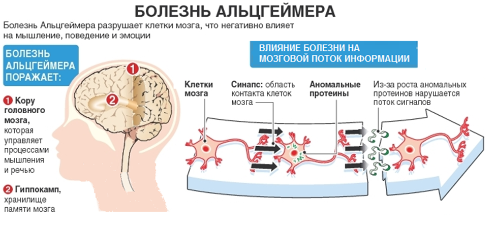 Нервная система в пожилом возрасте. Очаг поражения при болезни Альцгеймера. Патогенез болезни Альцгеймера схема. Болезнь Альцгеймера механизм развития. Болезнь Альцгеймера деменция.