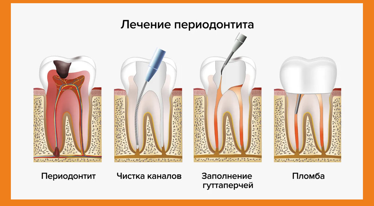 Ощущение как будто зуб. Ощущение как будто зуб