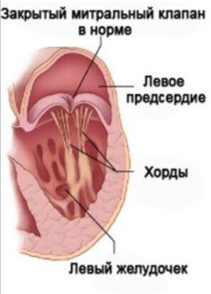 фото взято из интернета для наглядности