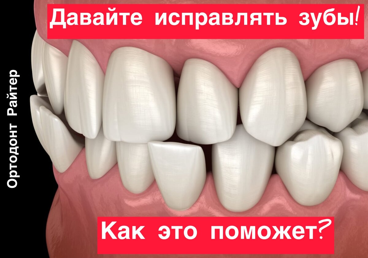 Требуется исправить прикус