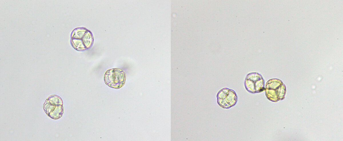 Фото пыльцы брусники (слева) и клюквы болотной (справа), гербарии и образцы пыльцы предоставил А. Моисеев, г. Тихвин, Ленинградская область (фото Р.Г. Курманова)
