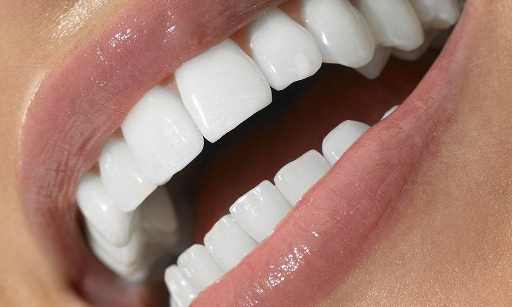 фотокомпозитные виниры. фотокомпозитные виниры. виниры на передние. фотокомпозитные виниры. виниры на передние.