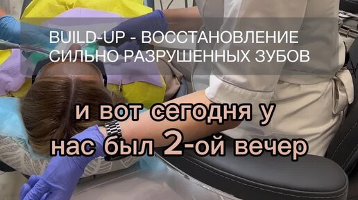 Восстановление сильно разрушенного зуба коронкой - билд ап